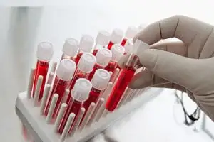 Food Detective czy IMMUNOdiagDIETA - który test wybrać?